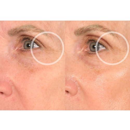 SiO SiO Beauty FaceLift - Reusable Anti-Wrinkle Patches for Neck, Forehead, Eye & Smile - Overnight Smoothing Silicone for Fine Lines, Wrinkles, and Aging