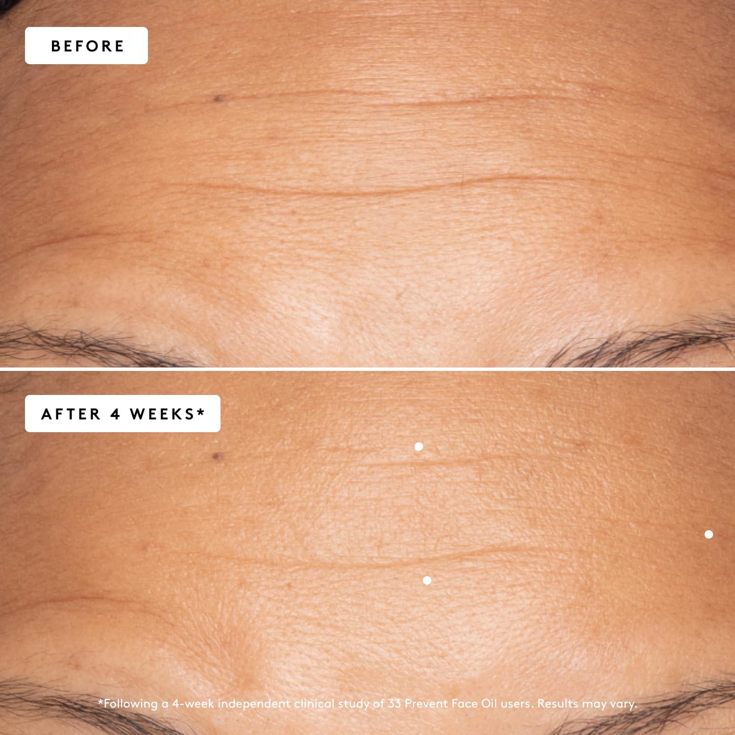 Naked + Thriving Naked + Thriving Prevent Anti-Aging Facial Oil - Vegan, Naturally-Derived Skin Care & Face Oil (1.18 oz/35 mL)