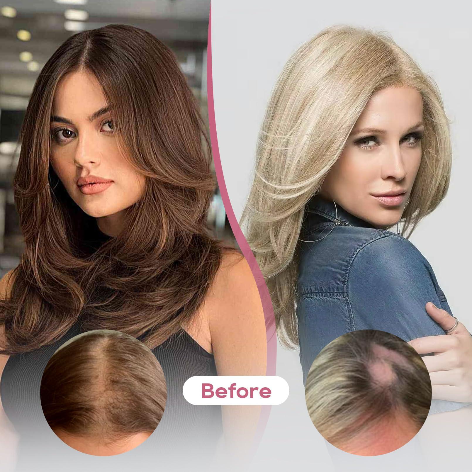 REECHO REECHO Real Human Hair Topper, 10 inch Women Hair Toppers for Thinning Hair, 100 Percent Human Hair Large Coverage Natural Hairpiece Wiglet, Swiss Base 4.5\"x3.5\", Silver White