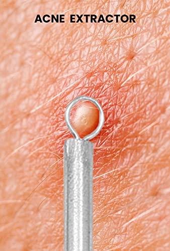 GMI-TWEEZERS GMI-TWEEZERS Blackhead Remover- 5 Piece Blackhead Extractor Tools Set for Pore Vacuum Extraction- Professional Grade Facial Cleaning & Blemish Removal- Blackhead Extractor Tools.