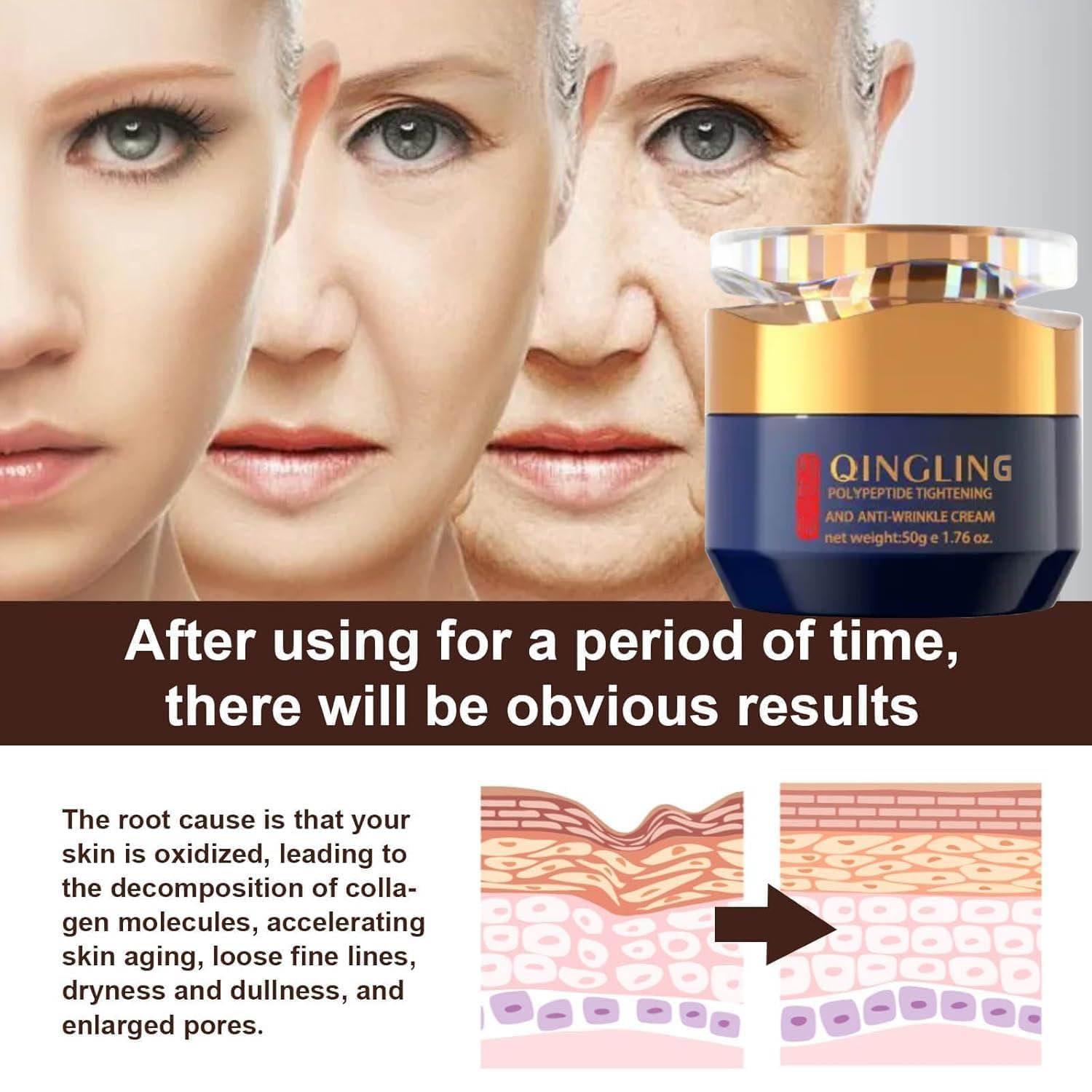 Regpem Qingling Face Cream, Qingling Crema Para Arrugas, Qingling Wrinkle Removal Cream, Polypeptide Tightening and Anti-Wrinkle Cream, Firming Anti-aging Eye Cream for Women Men (1)