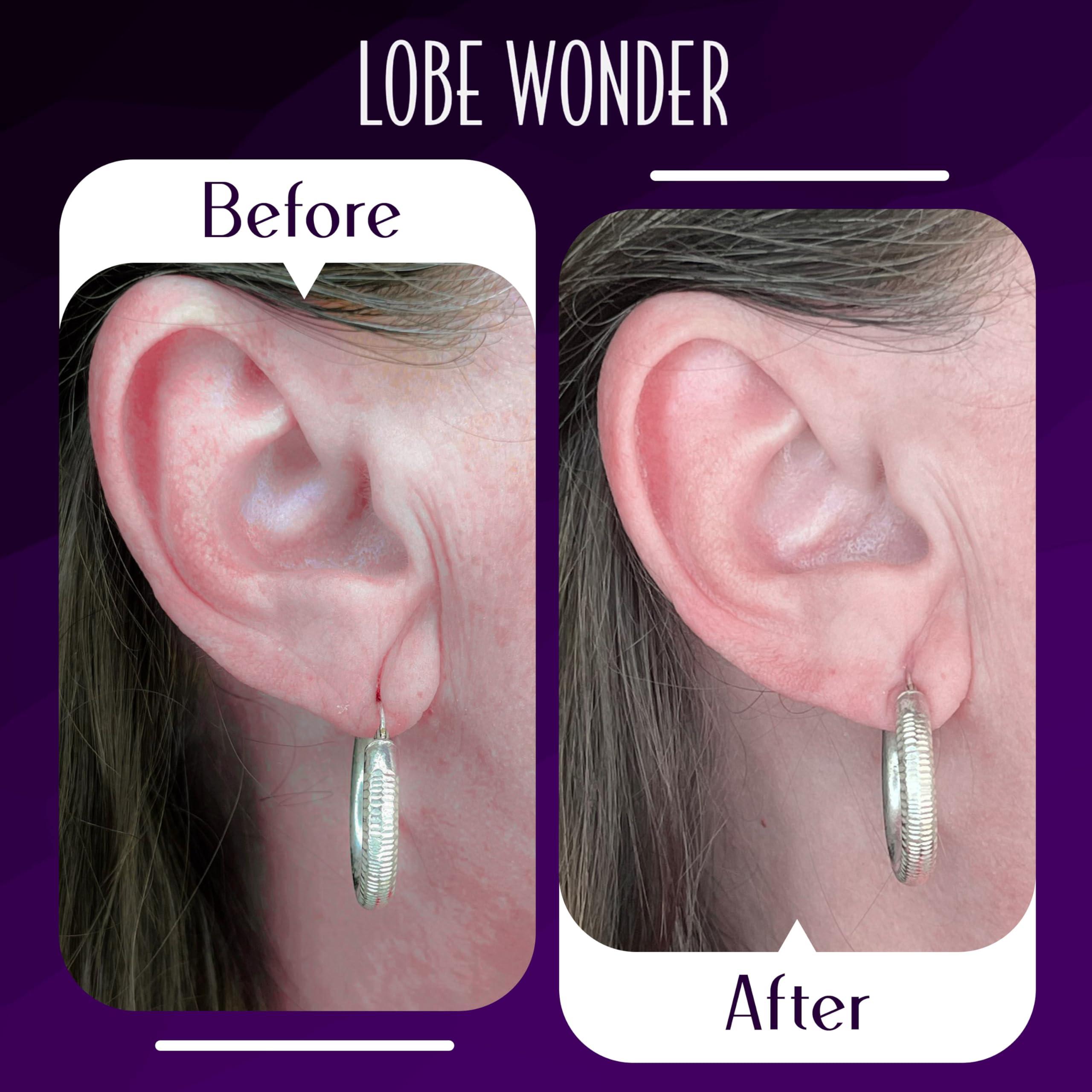 Lobe Wonder Lobe Wonder - The ORIGINAL Ear Lobe Support Patch for Pierced Ears - Eliminates the Look of Torn or Stretched Piercings - Protects Healthy Ear Lobes from Tearing - 420 Patches - Clear & Latex-Free