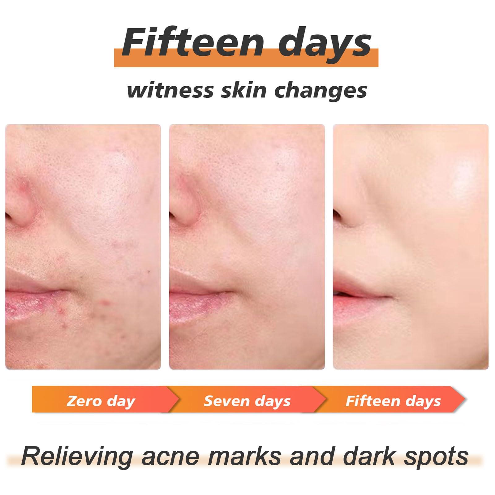 VGO VGO Snail Mucin 92% Moisturizer 1.76 OZ + Retinol Serum for Scars Skin, Face 1.69 OZ