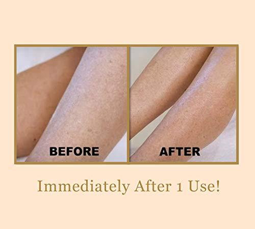 BEE STUNNING Bee Stunning DIAMONDBUFF Microderm Exfoliation Tool - At Home Professional BODY Diamond Crystal Microdermabrasion for Glowing Youthful Skin - Soften Crepey Skin, Fine Lines, & Improve Rough Texture!