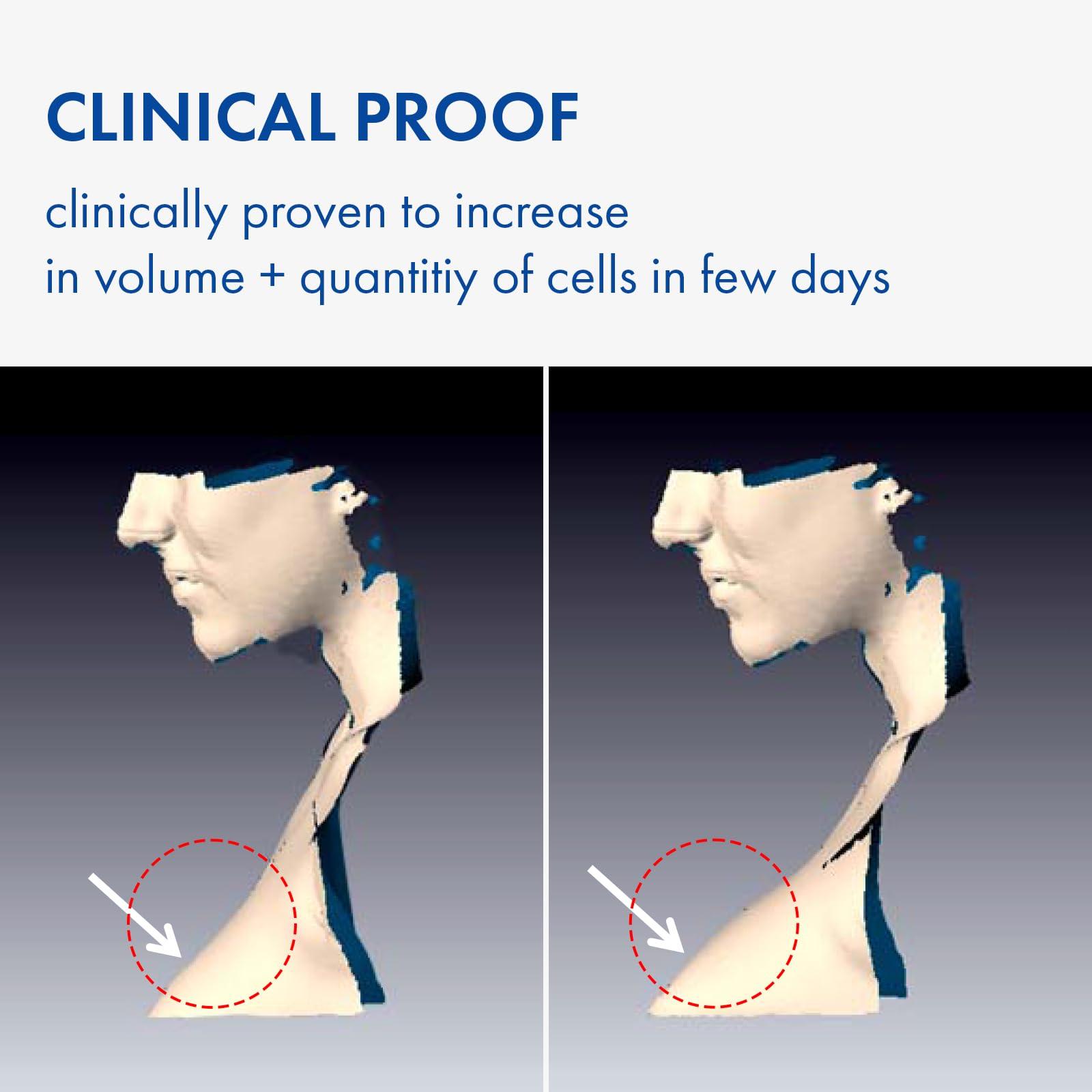 TOSOWOONG TOSOWOONG Volufiline Serum, 100% France Sederma Volufiline Concentrate for Plumping, Skin firming, Boost and Glass skin, glow Skincare for Face, lip and body, 11ml 0.37 fl. oz.