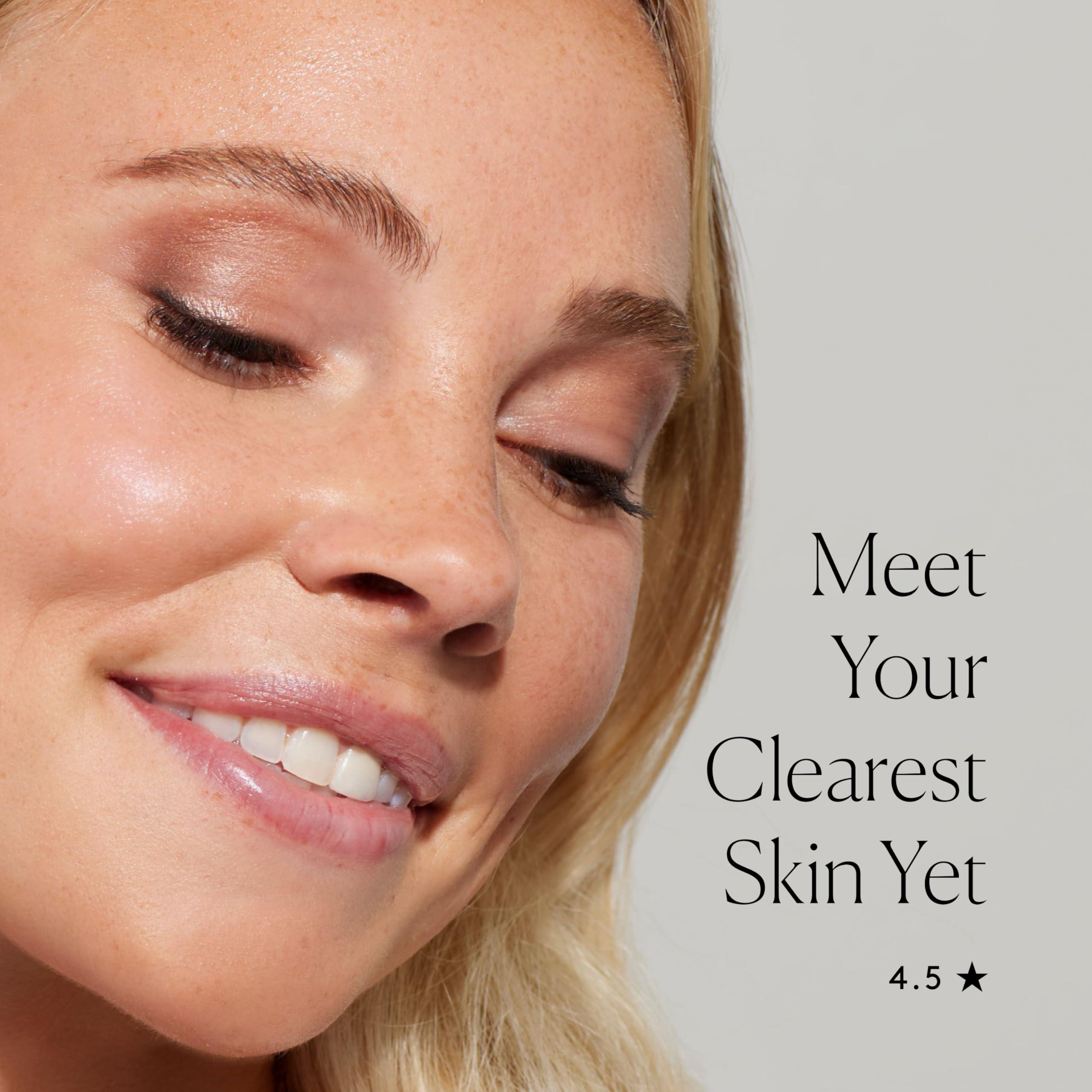 Naked & Thriving Naked & Thriving Clear Blemish & Pore Correcting Gel - Naturally-Derived With 3 Gentle Acids to Help Unblock & Cleanse: Salicylic, Shikimic, Mandelic