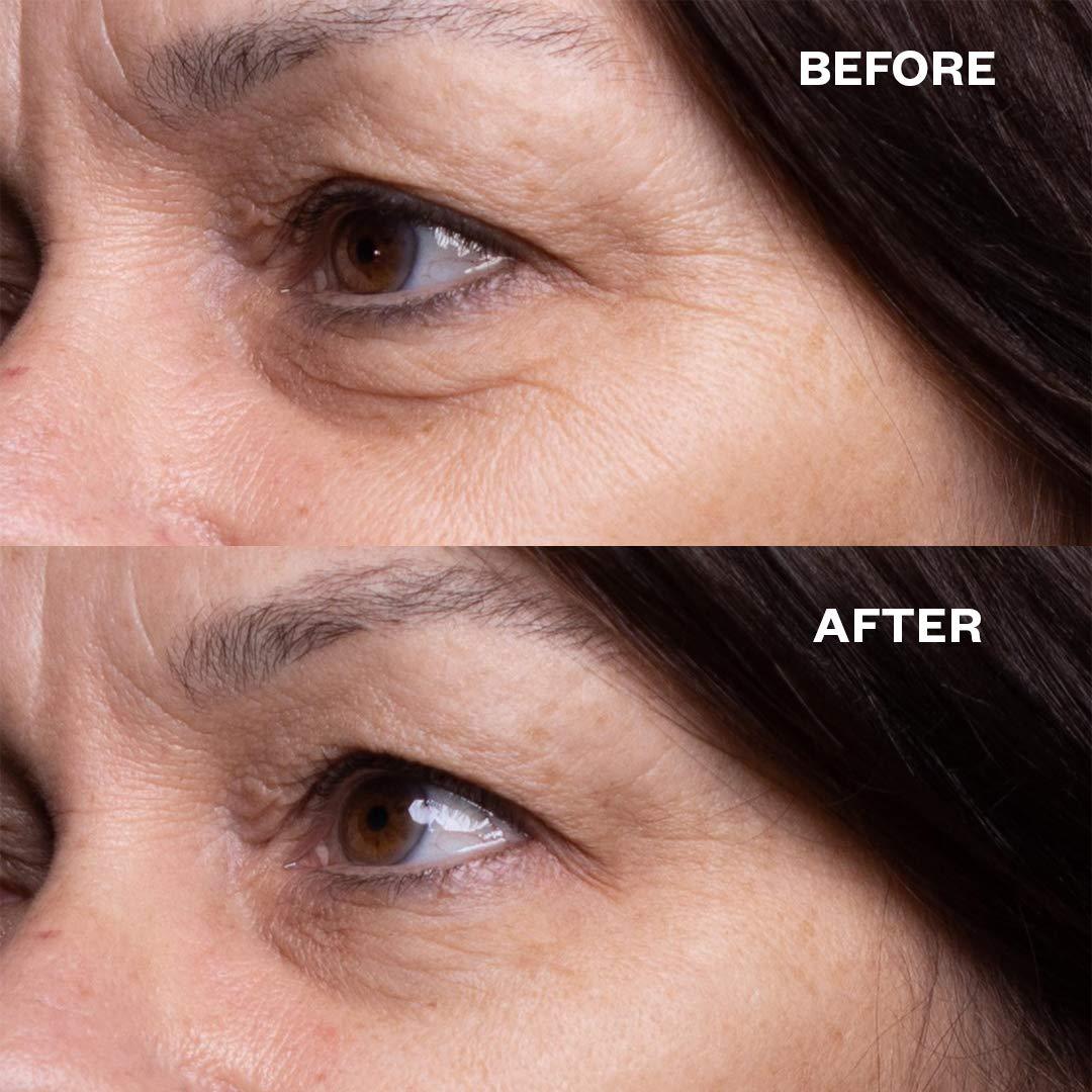 Wrinkles Schminkles Wrinkles Schminkles Faux-Tox Face Set: Silicone Patch Cleanser, Forehead Wrinkle Patches & Under Eye Wrinkle Patches