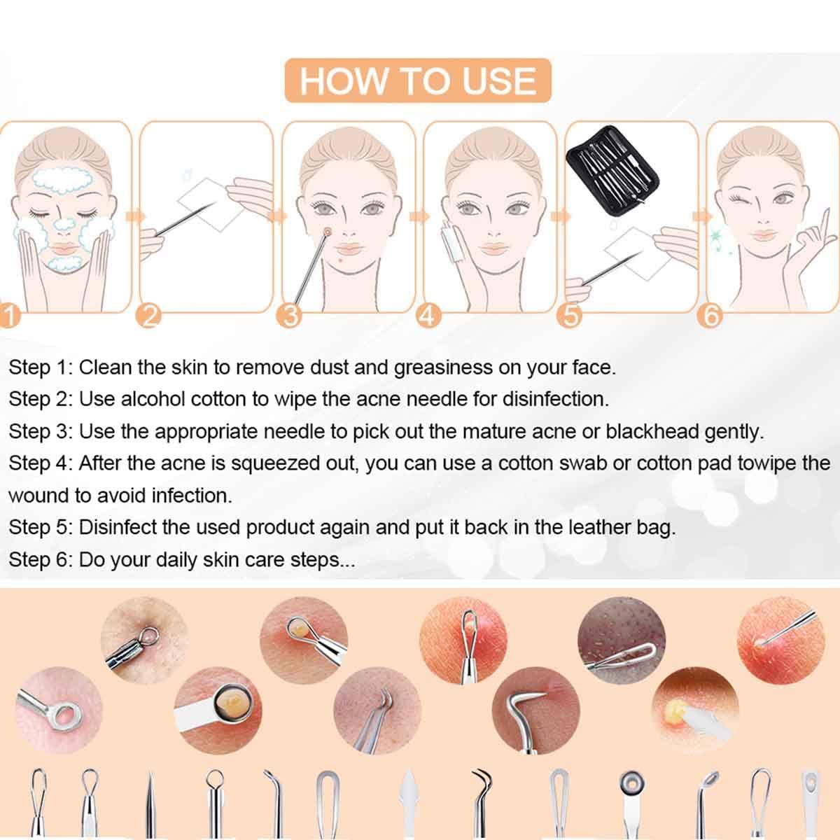 Eztronics Corp Blackhead Remover Pimple Popper Tool Kit - (9 Piece Kit) - Professional Stainless Pimples Comedone Extractor Removal Tool