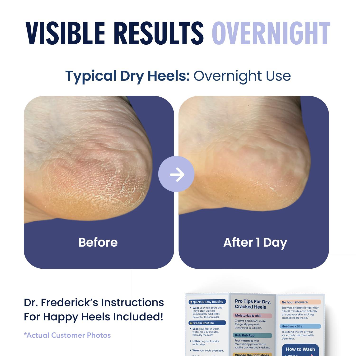 Dr. Frederick's Original Dr. Frederick's Original Moisturizing Fuzzy Heel Socks - 2 Pairs - Cozy Gel-Lined Sleep Socks for Women & Men - Soothes Dry, Cracked Feet - Heel Repair - Lilac Leisure