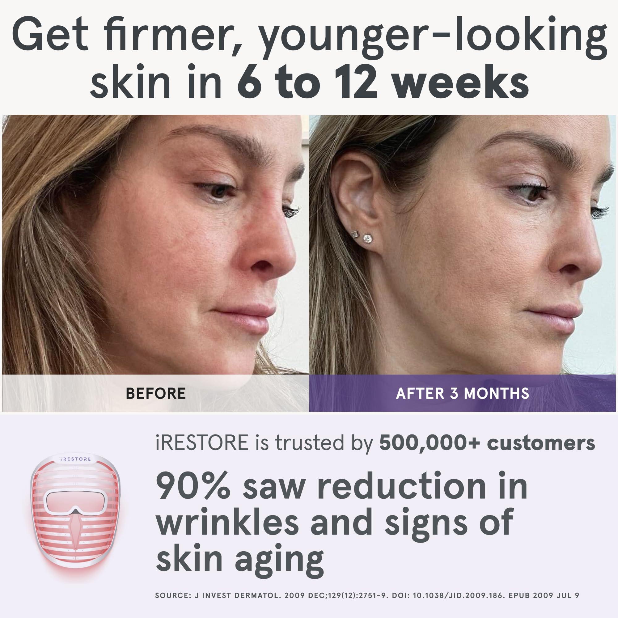 iRestore iRestore Skincare & Hair Care Power Duo LED Therapy for Radiant Skin & Laser Hair Growth System