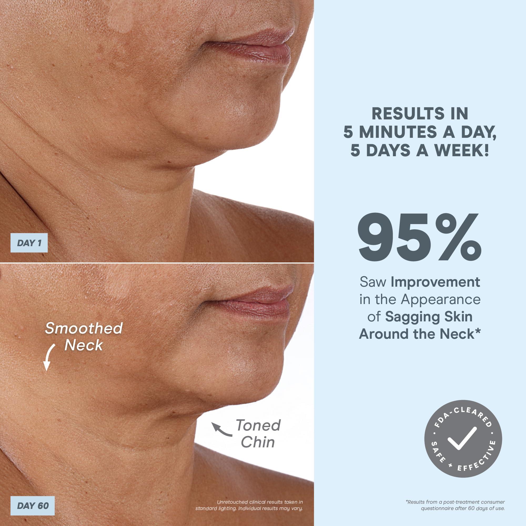 NuFACE NuFACE MINI+ Microcurrent Facial Device Kit - FDA Cleared Face Sculpting & Skin Tightening Device to Contour, Lift & Tone + Microcurrent Gel Activator & Silk Creme - Midnight Black