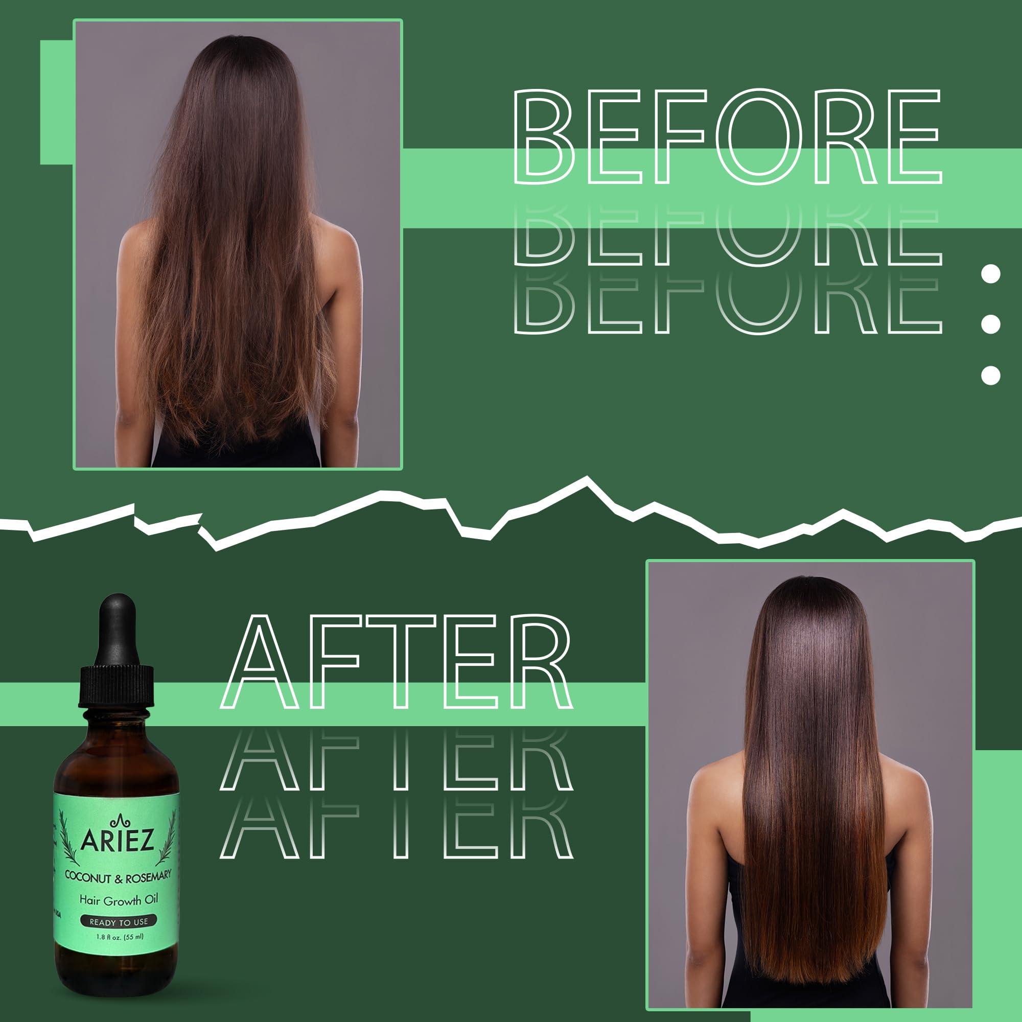 Ariez Ariez Coconut & Rosemary Oil Hair Growth Serum - Promotes Thicker and Fuller Looking Hair - For Dry & Damaged Hair - Anti Frizz- Stimulate Follicles, Promote Regrowth - Cruelty Free - 55ml