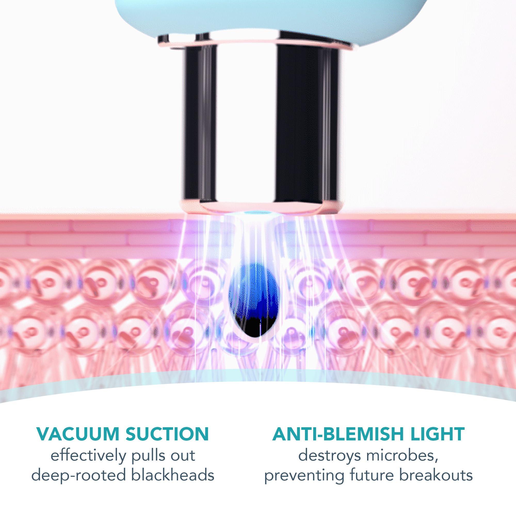 FOREO FOREO KIWI Whitehead & Black Head Remover for Face - Facial Skin Care Tools - Blackhead Extractor for Face & Nose - No Pore Strips Suction - Quick & Effective Blackhead Remover Device