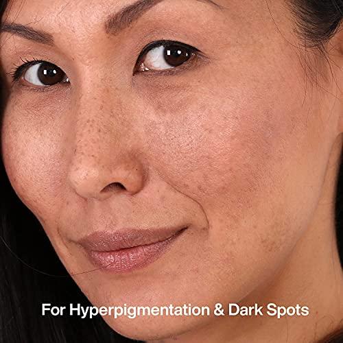 Getsocio Getsocio RE' EQUIL Skin Radiance Cream that helps in reducing hyper pigmentation, dark spots, age spots, melasma - 30g