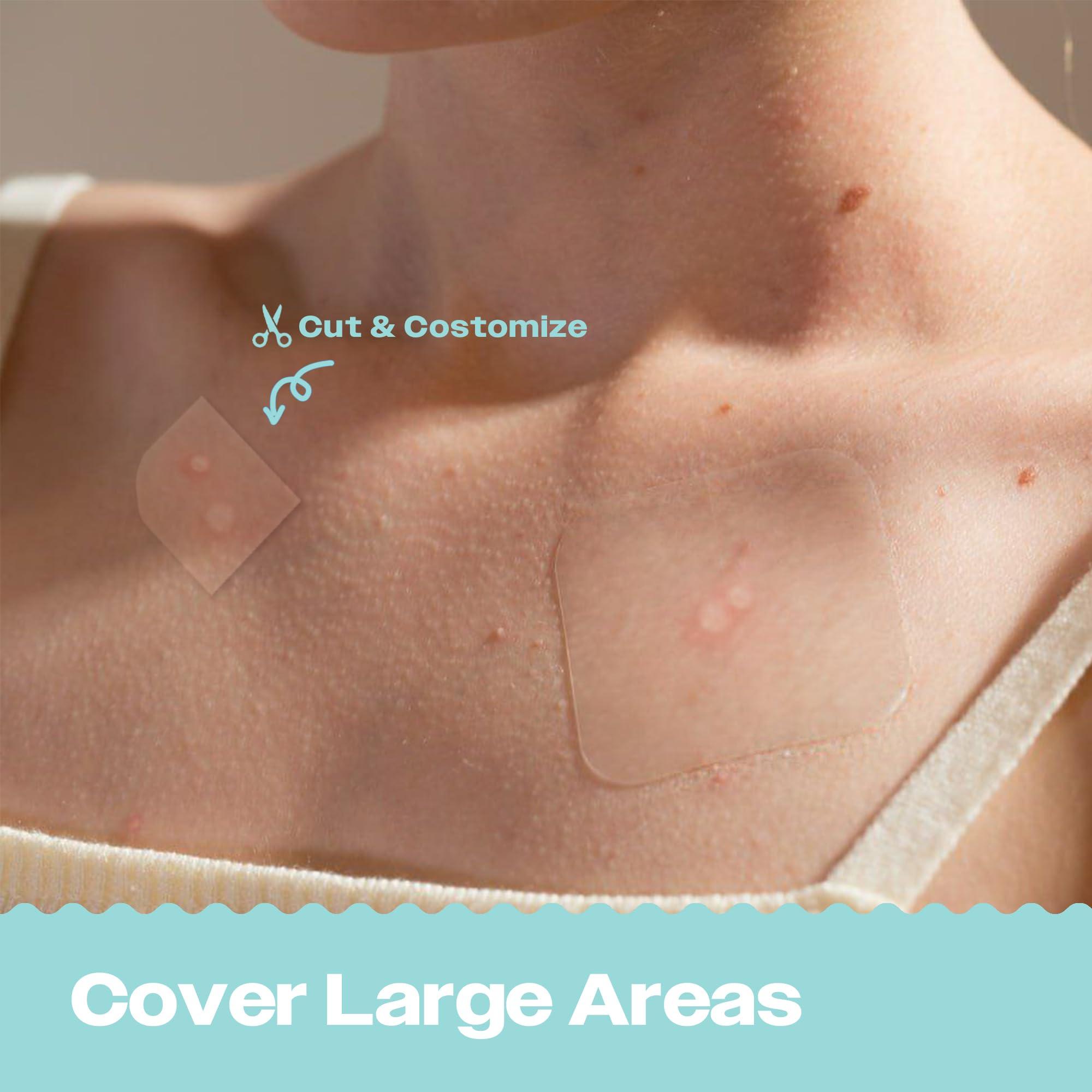 AVARELLE AVARELLE Acne Patches XL, FSA HSA Acne Patch Large | Pimple Patches for Face Cheek & Nose (8 Count) | Large Hydrocolloid Acne Treatment with Tea Tree, Calendula, & Cica by ZITOUT