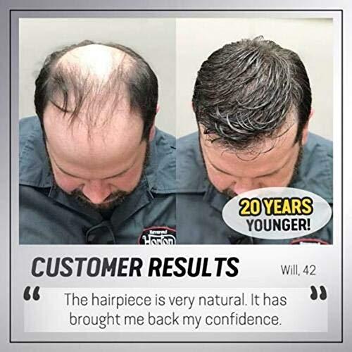 Qheng Qheng Bald Patch, Men Hair Topper Short Straight,Toupee Hairpiece Hair Extensions for Covering White Loss Hair for Men Women