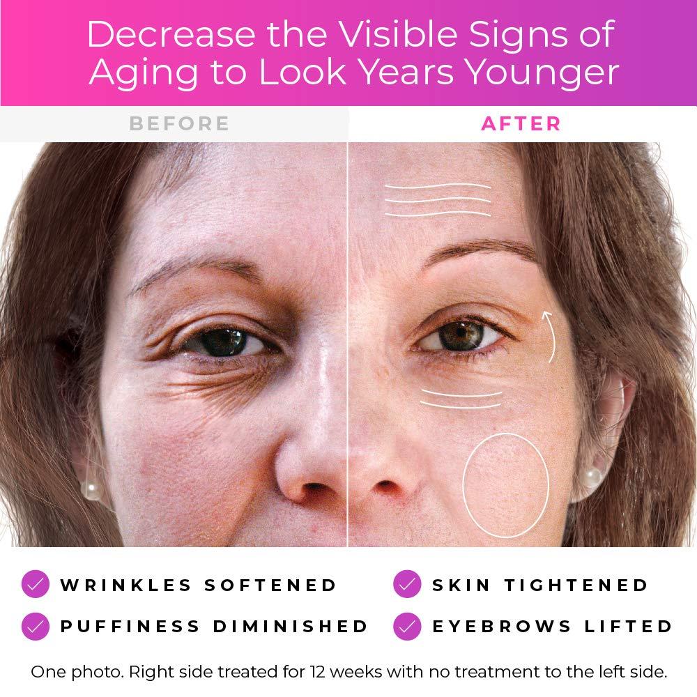 DermaWand Derma Wand Anti-Aging System - Portable Handheld Skincare Therapy Machine- Argon/Neon