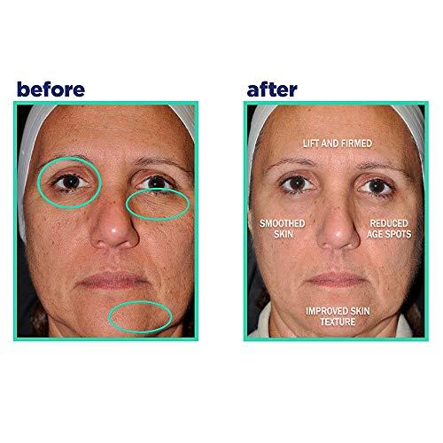 SkinKick SkinKick Clean+Natural Glow Renewal Serum For Face| Anti-aging Vegan Formula to Boost Firmness| Smooth Fine Lines and Wrinkles| Reduce Appearance of Acne Scars