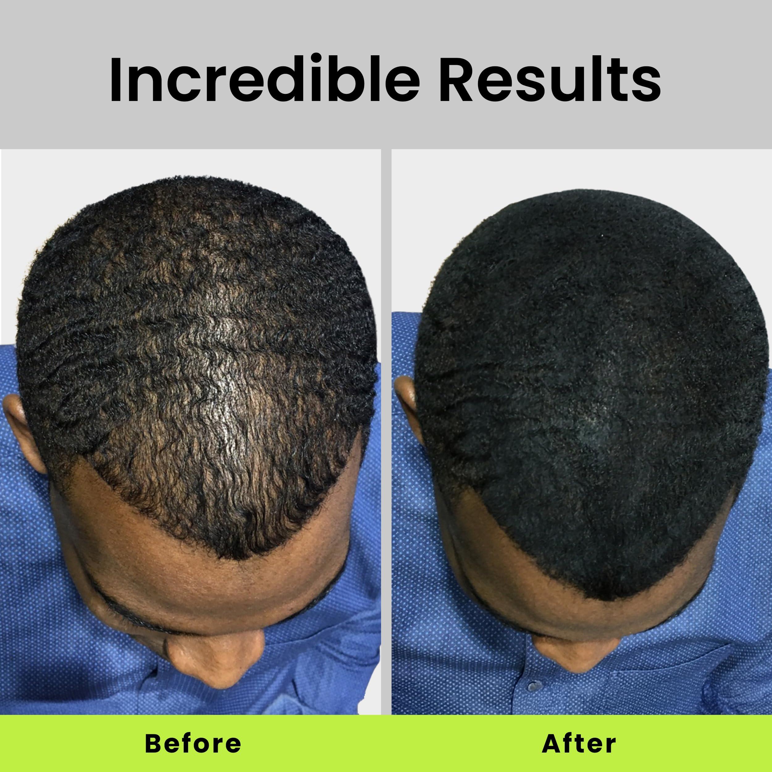 Eclipse Instant Hair Filler ECLIPSE Hair Fibers Grey for Thinning Hair for Women & Men to Conceal Hair Loss in 15 Seconds - 100% Undetectable Hair Building Fibers, 15g