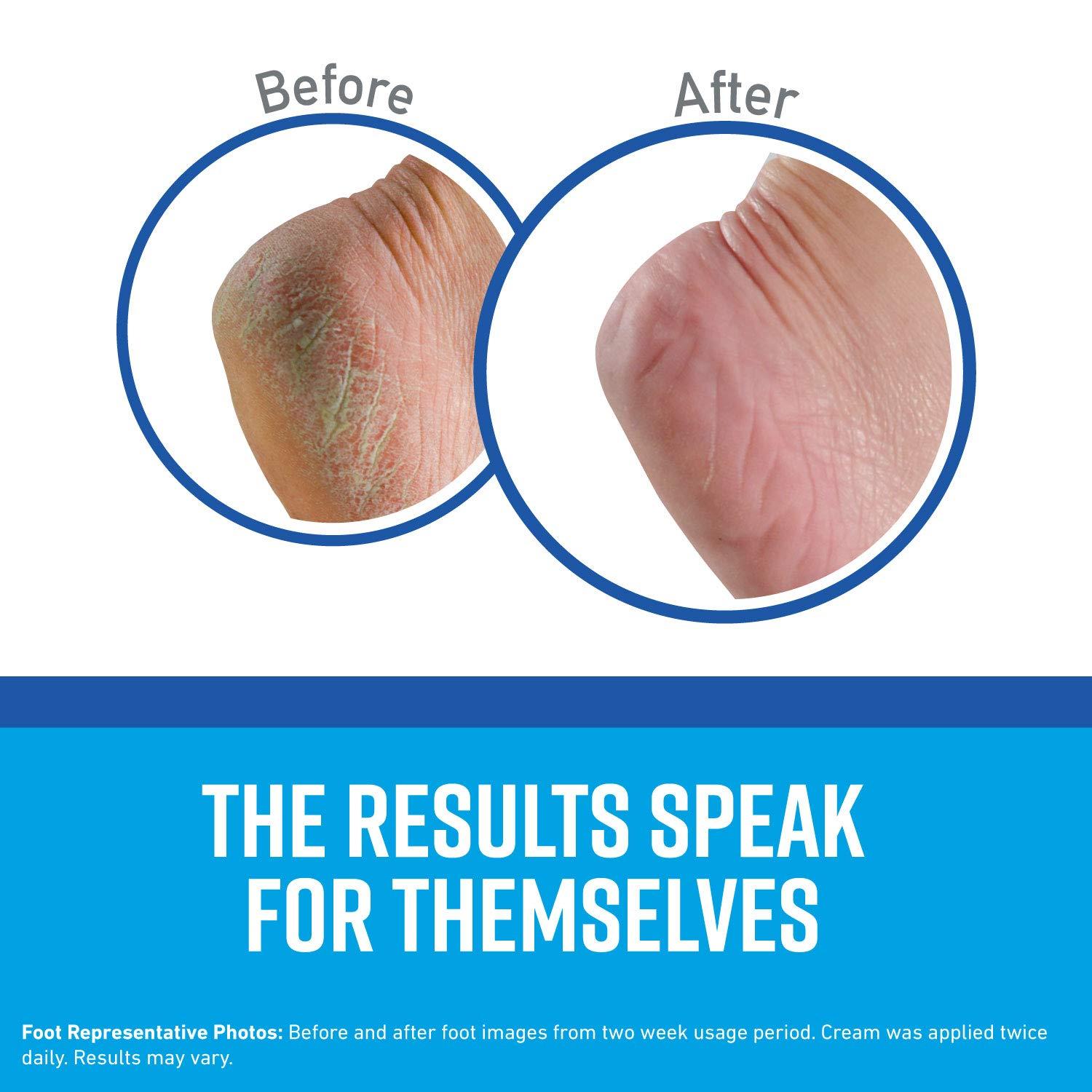 O'Keeffe's O\'Keeffe\'s K0320001-9 Healthy Feet Foot Cream in Jar (9 Pack), 3.2 oz