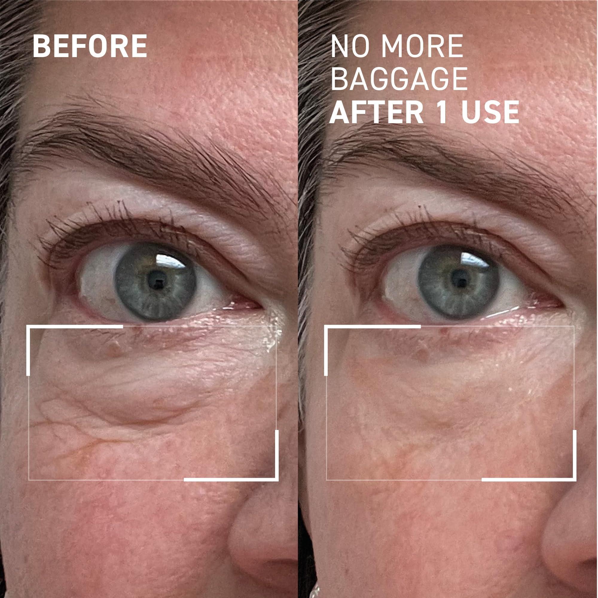 Dr. Brandt Skincare Dr. Brandt Skincare needles no more NO MORE BAGGAGE eye de-puffing gel TRAVEL SIZE, 7 g.