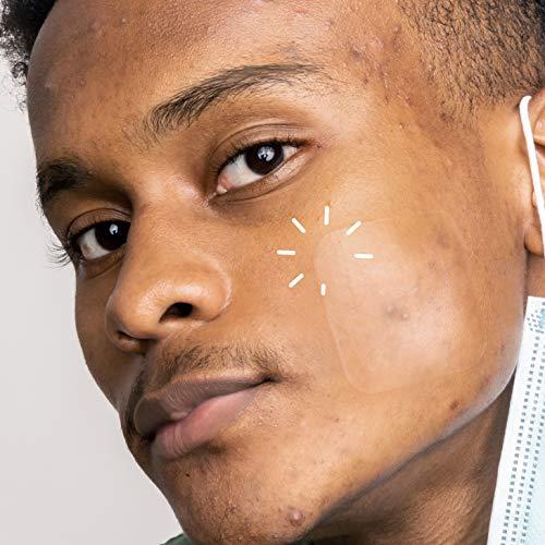 AVARELLE AVARELLE Acne Pimple Patch (40 Count) Absorbing Hydrocolloid Spot Treatment with Tea Tree Oil, Calendula Oil and Cica, Certified Vegan, Cruelty Free (VARIETY / 40 COUNT)