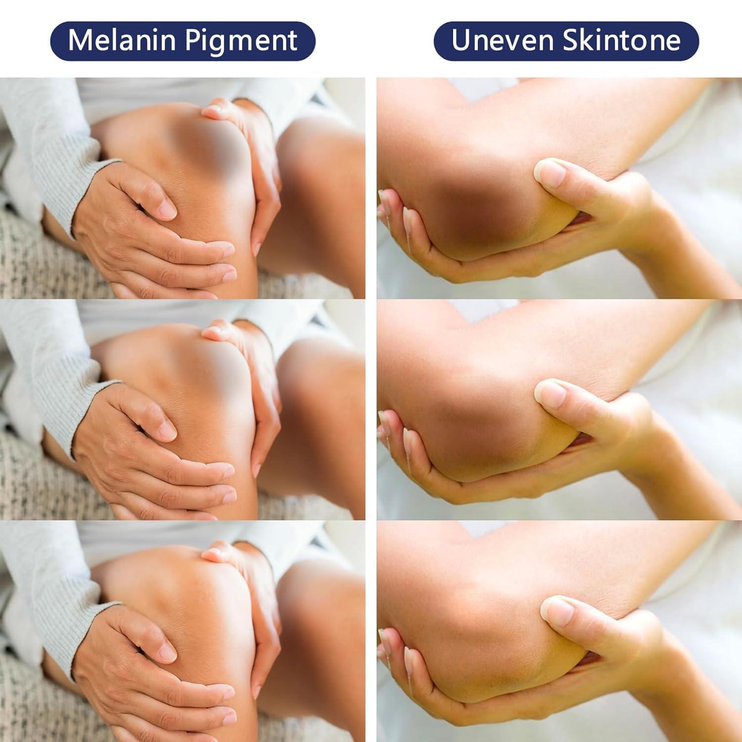 Gukei Gukei Intimate Areas Skin Lightening Cream Skin Bleaching Cream For Body Sensitive Intimate Area, Private Parts, Underarm, Knees, Elbows, Inner Thigh, Bikini Areas, Natural Skin Whitening Cream.