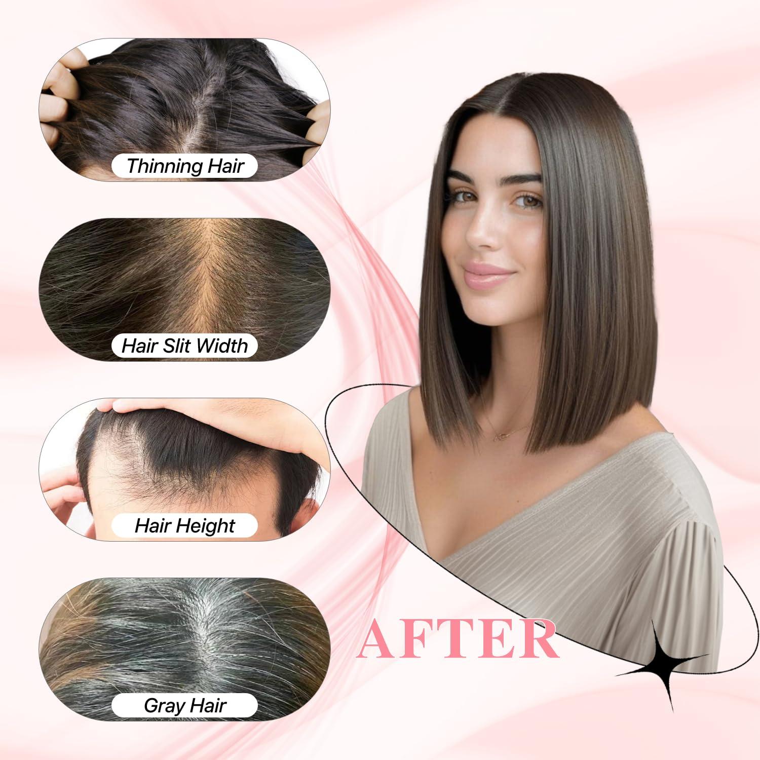 SEGO Pro SEGO Pro Hair Toppers for Women Real Human Hair Human Hair Toppers for Thin Hair Toppers Hair Pieces for Women No Bangs Adds Hair Volume 16 Inch 04 Chocolate Brown