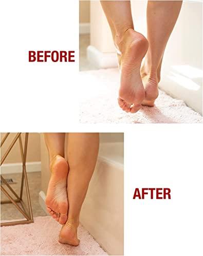 Kerasal Kerasal Intensive Foot Repair Skin Healing Ointment, 1 Oz and Zen Toes Moisturizing Gel Socks, One Pair