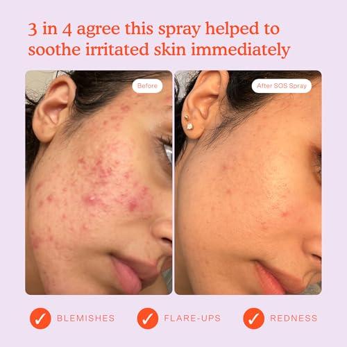 Tower 28 Tower 28 SOS Daily Rescue Facial Spray for Sensitive Skin, Hypochlorous Acid Spray Helps Reduce Redness and Breakouts, Full Size Toner for Face, 4 FL Oz