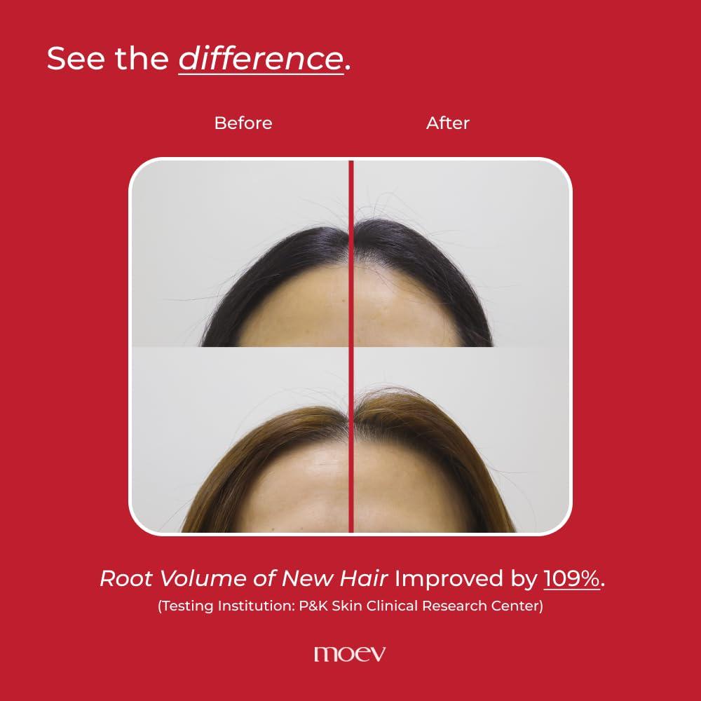 MOEV MOEV ANNURCATIN Shampoo, Biotin Hair Growth Volumizer Korean Anti Hair Loss Shampoo for Women, Build Lift, Natural Sulfate and Paraben-Free Apple Fresh Cleanser, Strengthens Weak Hair 10.14 fl.oz.