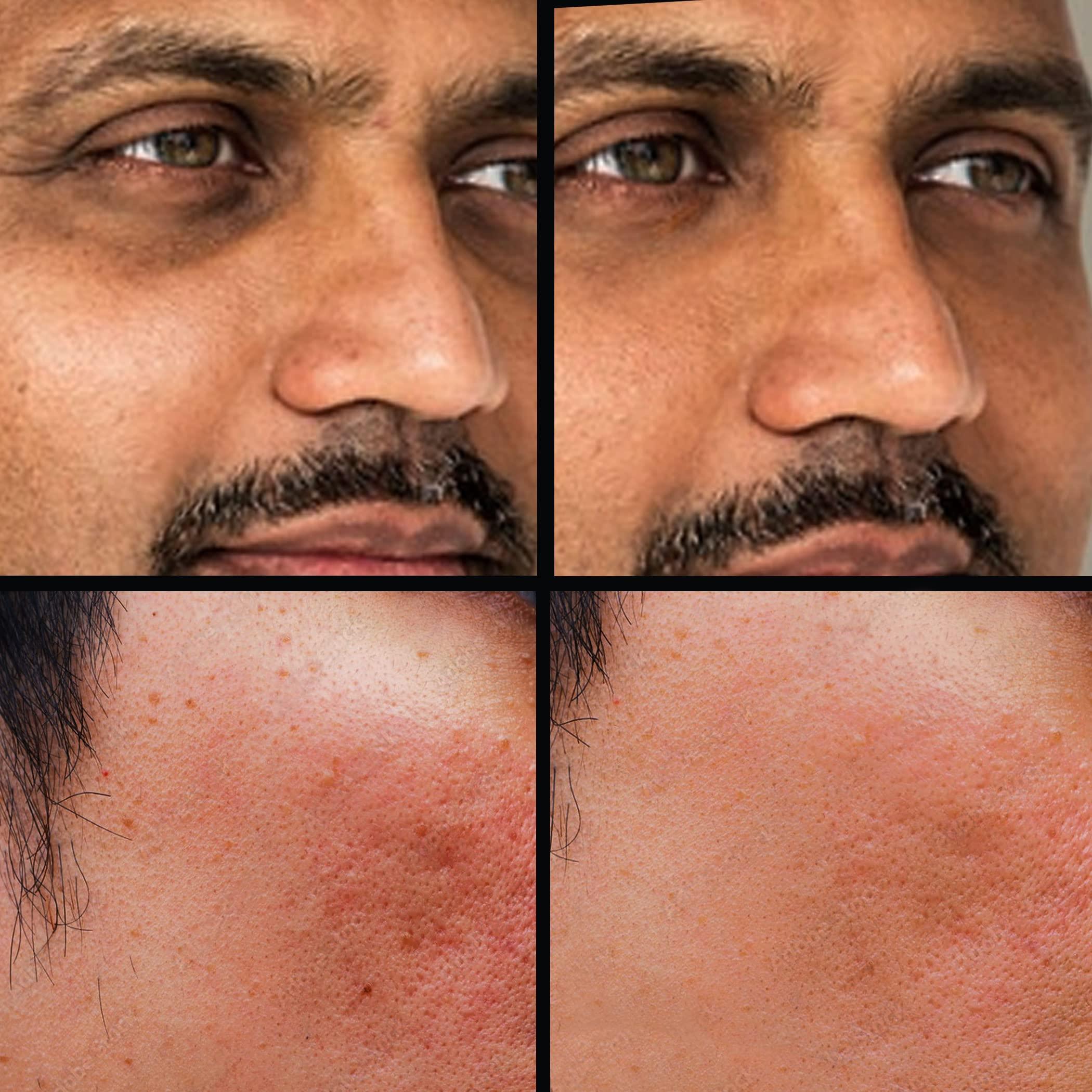 KODE Mens KODE Mens Concealer (Lightest) Dark Circle Under Eye Cream Corrector, Multi-Use, Pimples, Scars, Rashes