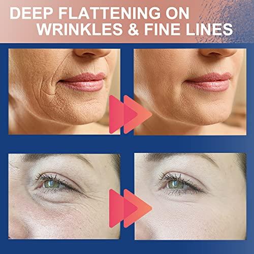 Akissos Akissos Forehead and Between Eyes Wrinkle Patches The Original Wrinkle Patch Non Invasive Wrinkle Smoothers for Forehead Wrinkles 5cm*5m 1 Roll…