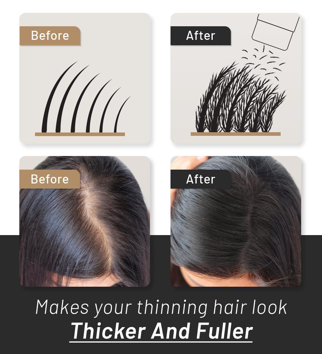 CONFIERR CONFIERR Keratin Hair Fibers for Men & Women - Fill In Fine or Thinning Hair, Instantly Thicker, Fuller Looking Hair (White 30g)