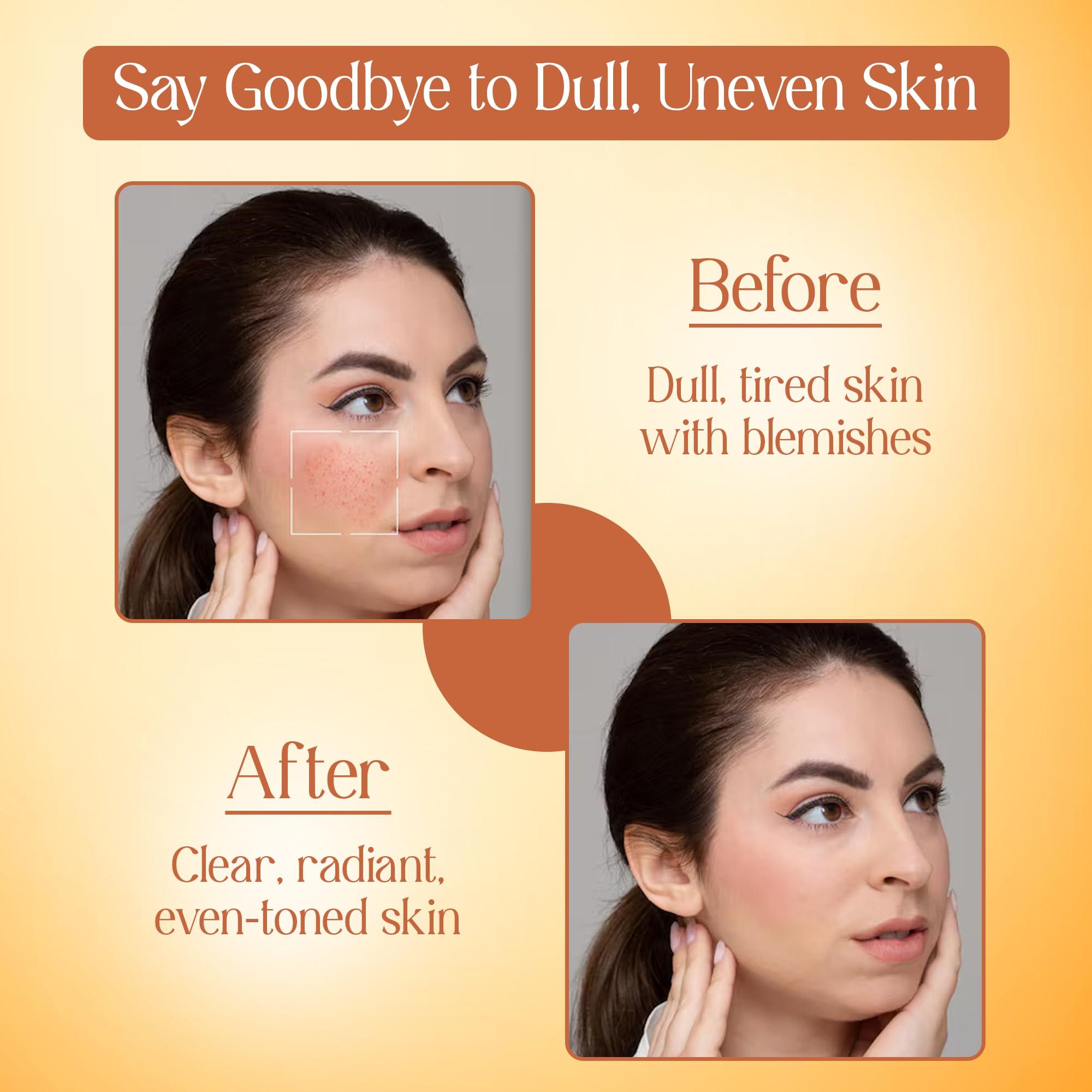 HIM AYURVEDA HIM AYURVEDA VITAMIN C FACE WASH ERICHED WITH LEMON, HONEY,PAPAYA,TURMERIC, ALOE VERA AND KASHMIRI SAFFRON - NO PARABENS, SULPHATE, SILICONES, 200ML