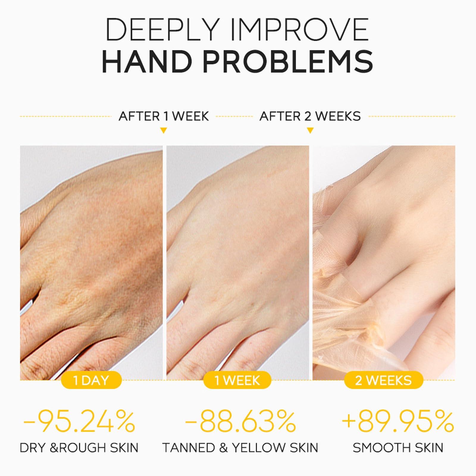 Inkjoy Honey Peel Off Mask,Deep Moisturizing Milk Honey Peel Off Hand Wax,Hydrating Exfoliating Hand & Foot Peeling Mask,Hand Moisturizing Gloves,Nourishing Brightening Serum for Dry Rough Skin for Women