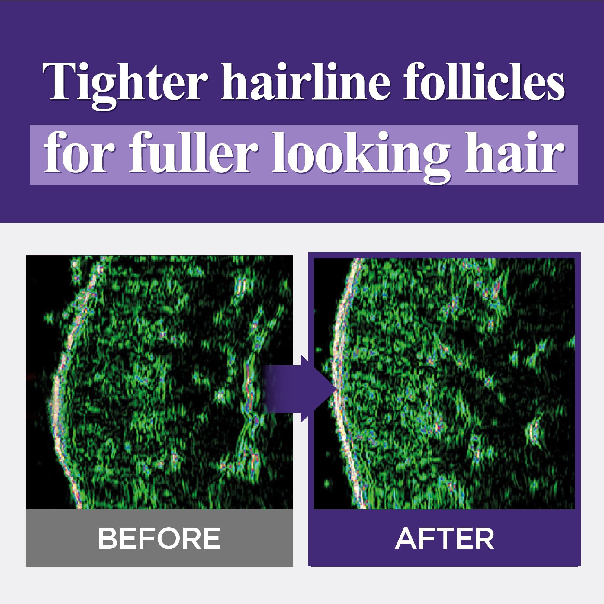 Dr.Groot Dr. Groot Intensive Hair Loss Control & Volumizing Shampoo for Thin Hair (400 ml/13.53 fl oz) - Hair Thickening. Biotin, Collagen & Retinol