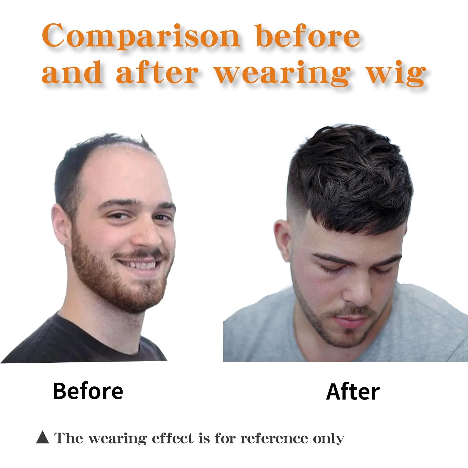 Askuang Askuang Hair Toupee for Men Clip in Crown Topper Hair Extensions Mens Hair Piece for Hairline Loss Covering White Loss Hair Toupee Wig Short Hair Toppers for Men Natural Black