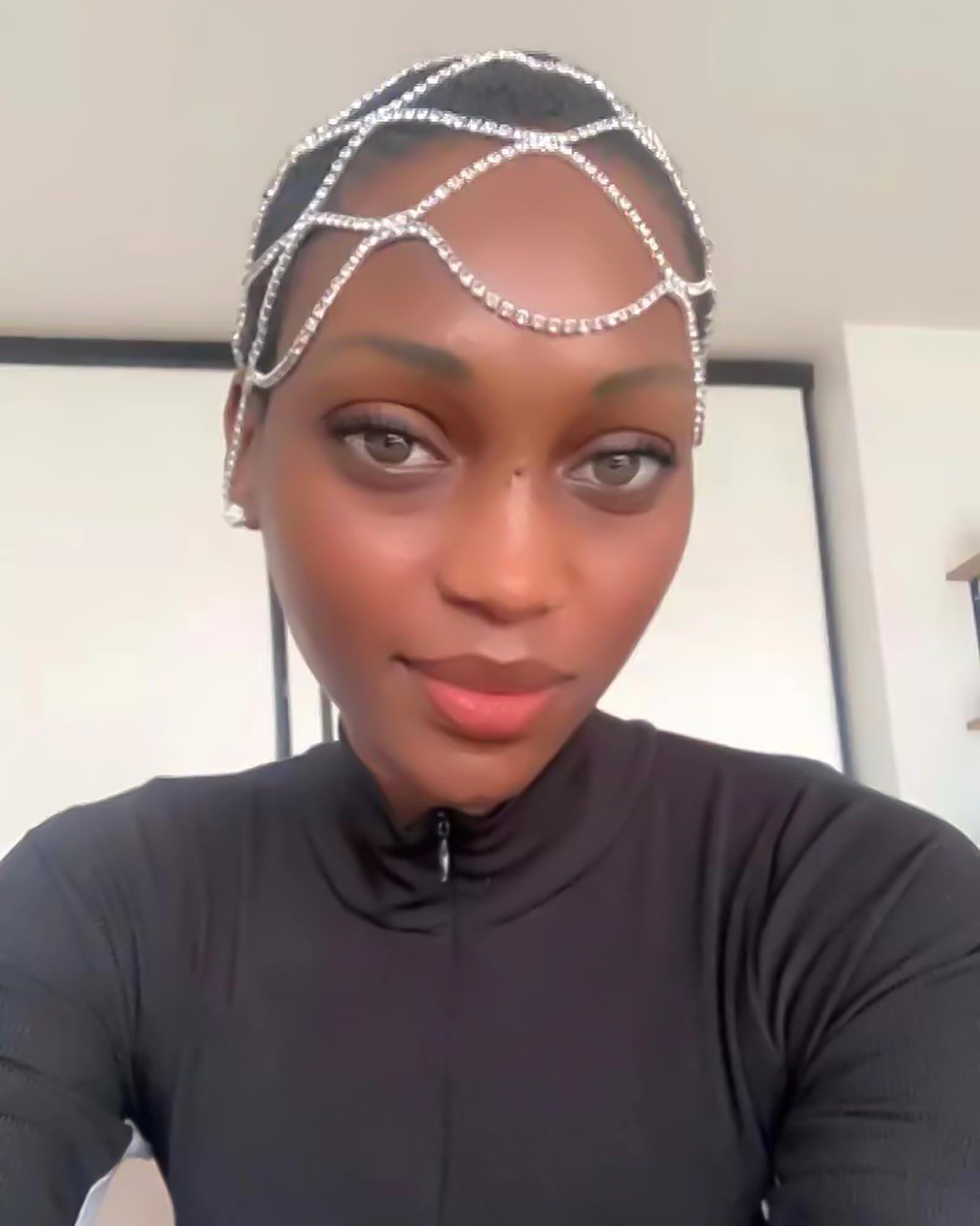 Eztronics Corp Blackhead Remover Pimple Popper Tool Kit - (9 Piece Kit) - Professional Stainless Pimples Comedone Extractor Removal Tool