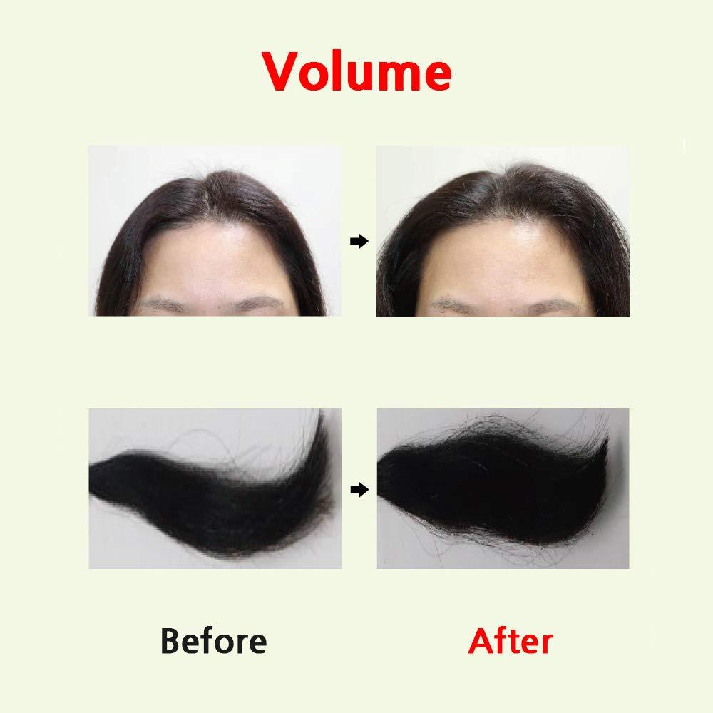 CH6 CH6 SCALP SSAG SERUM 140ml