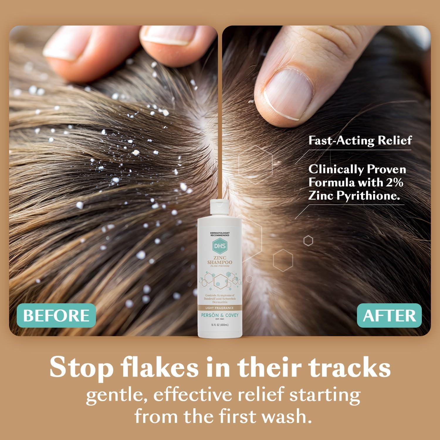 DHS DHS Zinc Shampoo, 16 Oz (Pack of 2)