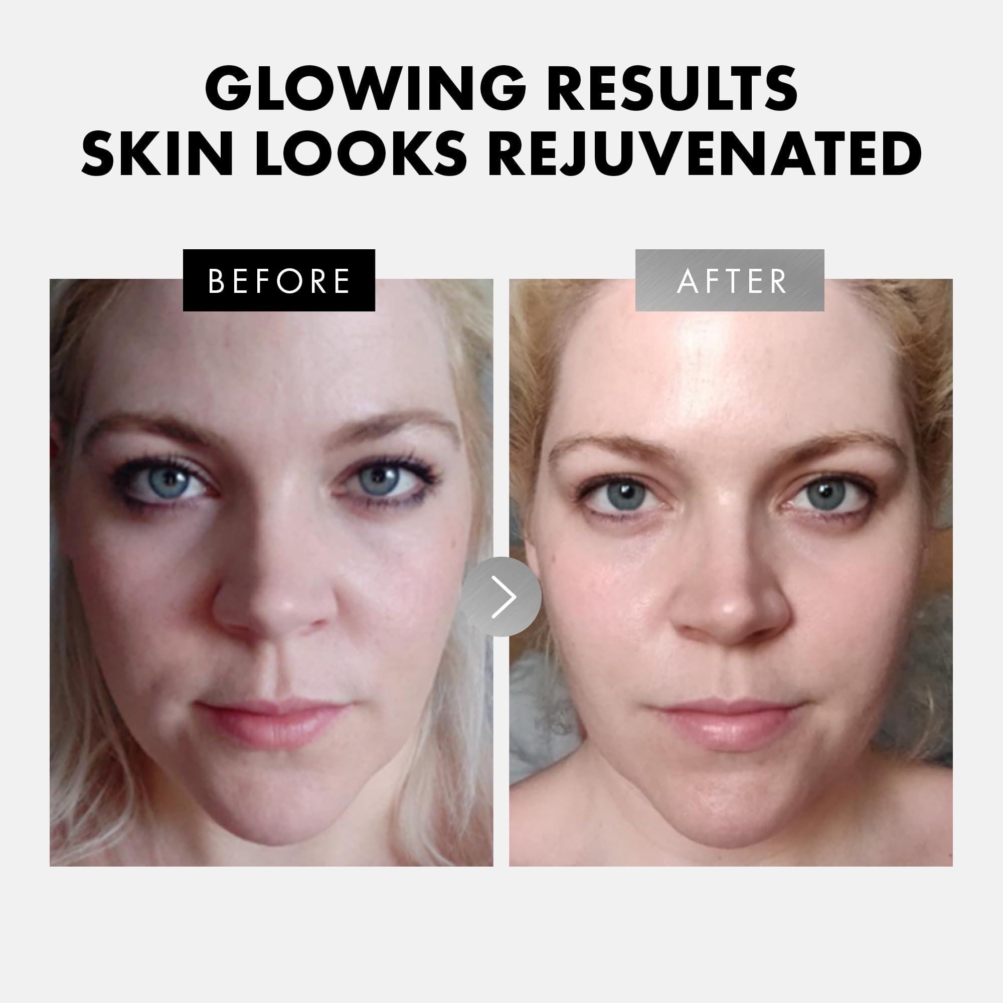 Eclat Skincare Eclat Skincare Face Serum Set - Vitamin C Serum for Radiance, Retinol Serum for Wrinkles