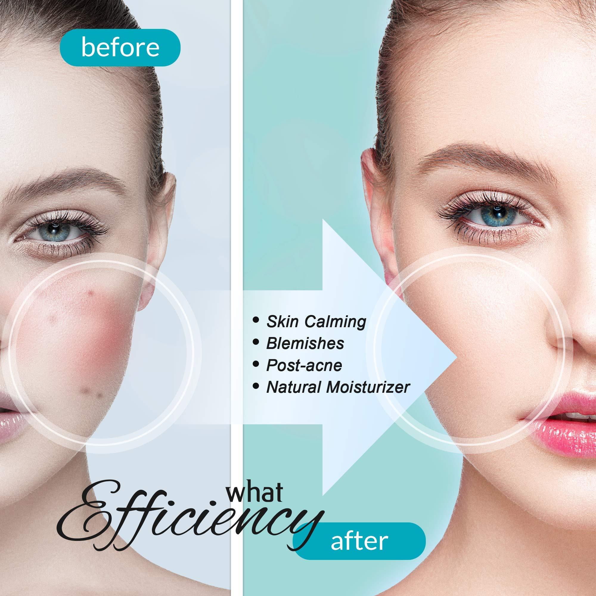 Leche Carenology Blue Tansy Regenerating Organic Face Serum: Oil-Free, Antioxidant Natural Ingredients Witch Hazel, Neroli Oil, Beta glucan for Pure Poreless 1.7 Fl.Oz