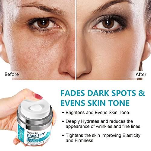 SWETIYOU Dark Spot Remover for Face, Fast-Acting Dark Spot Corrector Remover for Face and body Hyperpigmentation, Fades Melasma, Freckle, Sun Spots, Evens Skin Tone, Age Spot Remover for Women Men