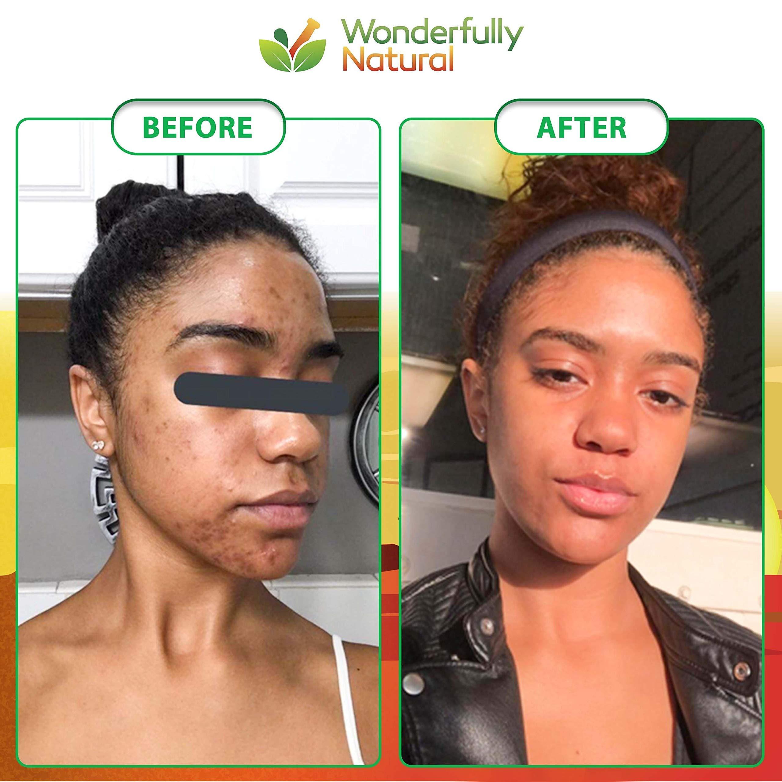 Wonderfully Natural Organic African Black Soap - For Acne & Dark Spots | Natural Vegan and Cruelty Free Satisfaction Guarantee 1lb bar | 90 day Supply