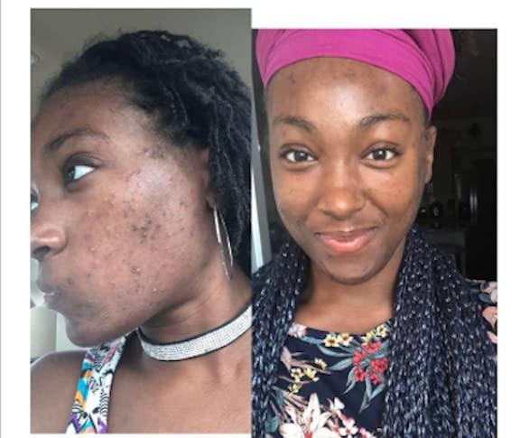 Herbal Power Peel Herbal Power Peel- Chemical & Acid Free Green Herbal Deep Sea Peel-Professional or Home Use