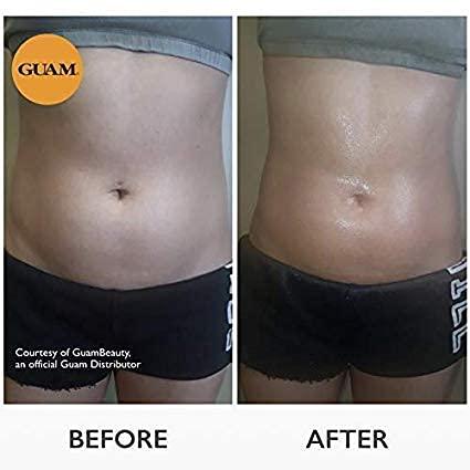 Guam GUAM Anti Cellulite Stomach Wraps, INFRARED Body Wrap for Flat Tummy, FIR Tummy Wrap Cellulite Remover, Belly Cellulite Treatment, Stomach Skin Firming and Tightening Body Mud (2.2LB)