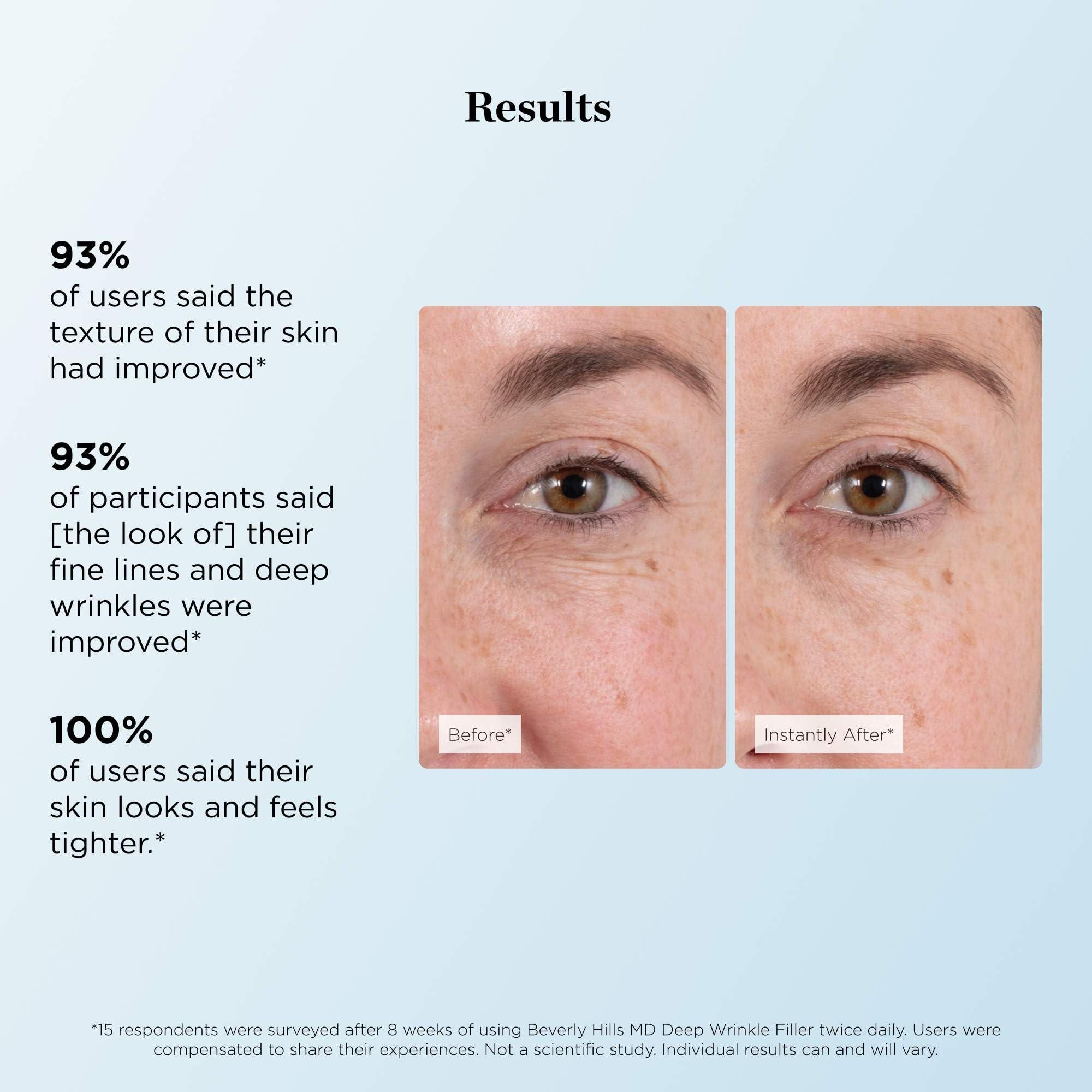 Beverly Hills MD Beverly Hills MD Deep Wrinkle Filler- Decrease Appearance of Deep Wrinkles on Contact, Anti-Aging Serum for Smooth, Lifted Complexion- Helps Correct Fine Lines & Creases w/Diamond Dust & Polymers