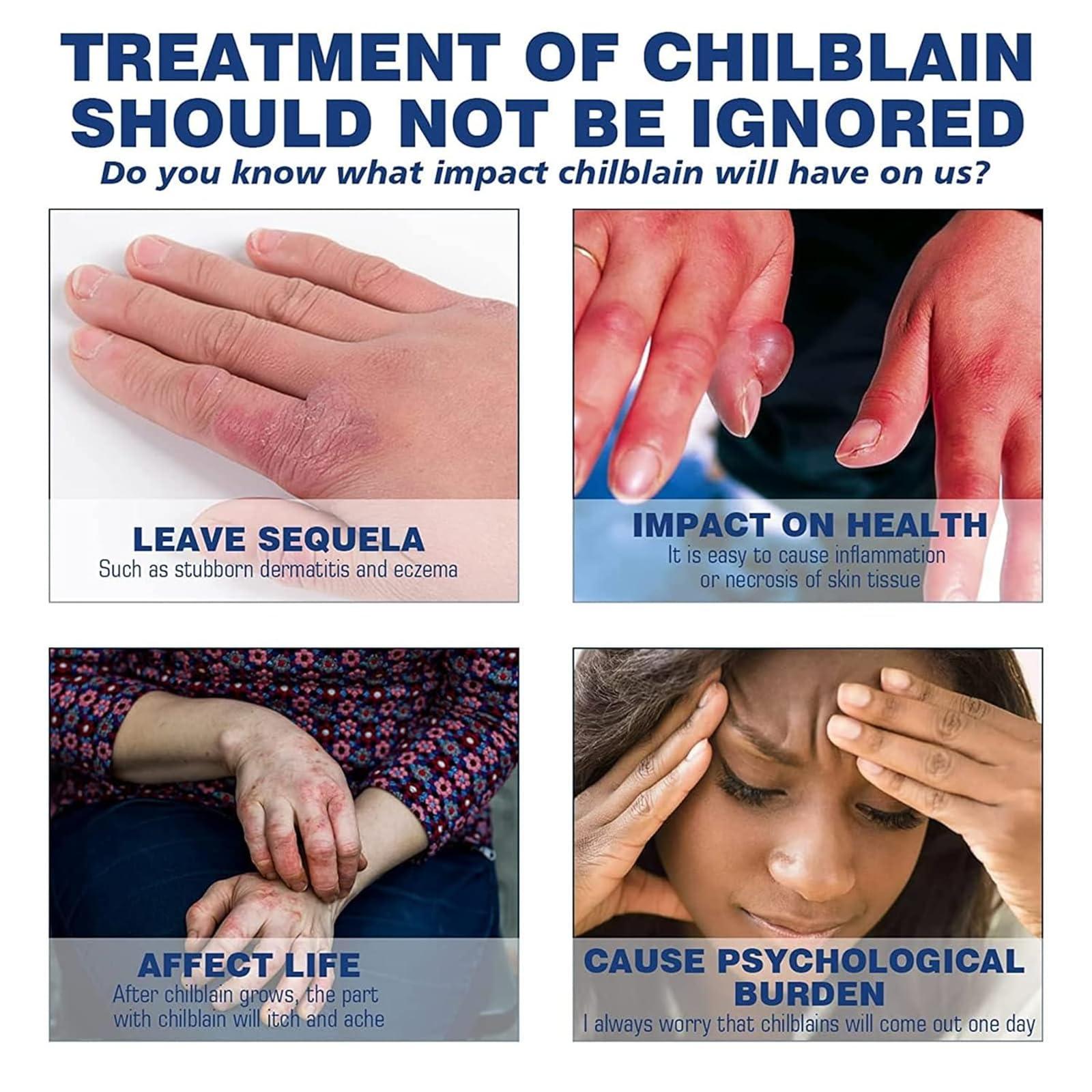 DRXVE DRXVE Chilblain Cream, Anti-cracking Frostbite Moisturiser Deep Nourishing, Anti Crack & Hand Foot Cream, Foot Repair Cream, for Dry Cracked Heels Callus Remover (2 Pc)