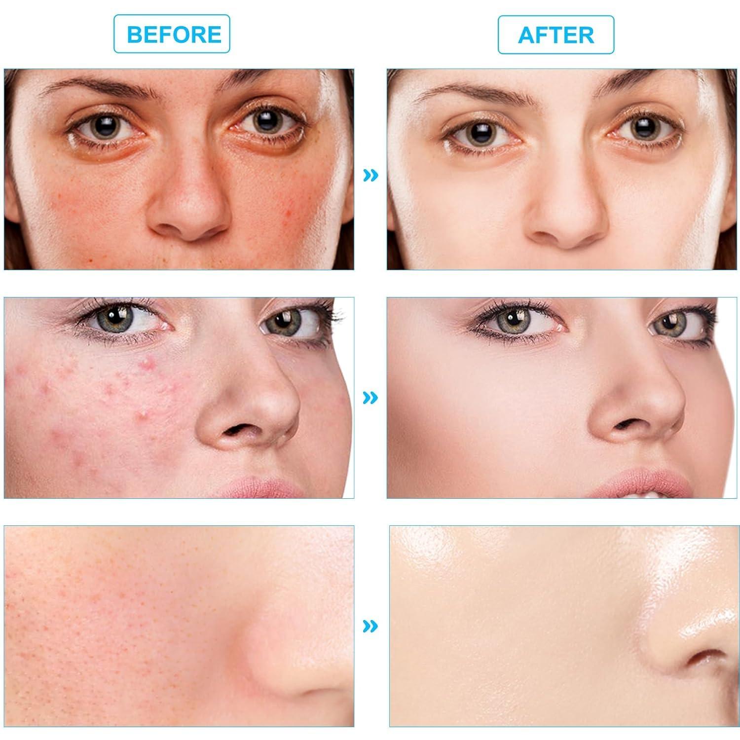 NIFEISHI NIFEISHI Turmeric Face Scrub Pads, 60pcs Kojic Acid and Turmeric Cleansing Pads with Vitamin B5 and Vitamin C, turmeric kojic acid cleansing pads for Face and Body